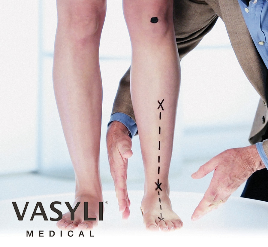vasyli heel pain orthotic